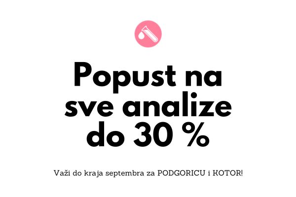 Specijalna ponuda do kraja Septembra